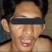 Seorang Mahasiswa Dianiaya Anggota Polisi di Halmahera Utara