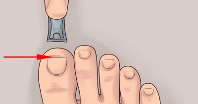 Sunnah Memotong Kuku Kaki pada Hari Jumat - Panduan Praktis 1 Sunnah Memotong Kuku Kaki pada Hari Jumat - Panduan Praktis