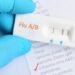 RI Temukan 62 Orang Tertular 'Super Flu', Terbanyak di 3 Wilayah Ini 8 RI Temukan 62 Orang Tertular 'Super Flu', Terbanyak di 3 Wilayah Ini