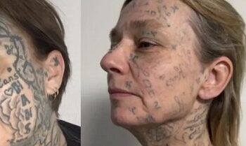 Kejam! Wanita Ini Dipaksa Tato 250 Nama Pacar di Tubuh & Wajah