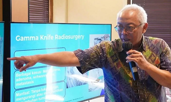 Deteksi Dini Tingkatkan Keberhasilan Penanganan Tumor Otak